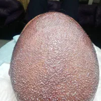 کاشت موی سر و ابرو|خدمات آرایشگری و زیبایی|جلفا, |دیوار