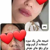 کرمات تصمینی|آرایشی، بهداشتی، درمانی|سوسنگرد, |دیوار