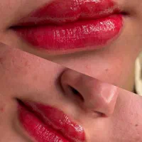 ارایش دائم میکروبلیدینگ، شیدینگ لب