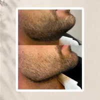 ریشات مکت میشه