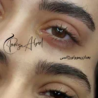 ریموو لب،ریموو خط لب،ریموو خط چشم،ریموو تتو ابرو