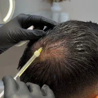 پی آر پی و مزوتراپی کلینیک دریا کنارک و چابهار