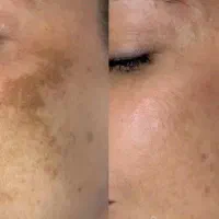 کرم ویتامین گاتیوضد لک قوی روشن‌کننده وجوانسازپوست
