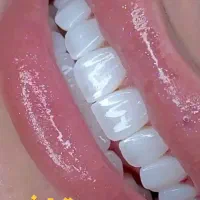 دندانپزشکی ایمپلنت کامپوزیت لمینت ( اقساط بدون سود|خدمات آرایشگری و زیبایی|تهران, الهیه|دیوار