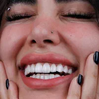 دندانپزشکی، کامپوزیت دندان|خدمات آرایشگری و زیبایی|تهران, تهرانپارس غربی|دیوار