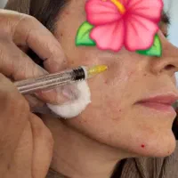 نیازمند مدل پی آرپی