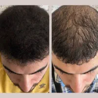 زمان زیادی نمیبره تا پر پشت شه