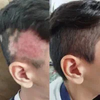 کمتر از ۳۰ روز بلندش کن