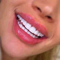 دندان کامپوزیت دندانپزشکی باهوش مصنوعی|خدمات آرایشگری و زیبایی|مشهد, دانشجو|دیوار