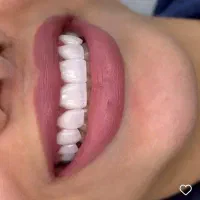 اموزش دندان سازی .ثابت ومتحرک وکامپوزیت|خدمات آرایشگری و زیبایی|شیراز, وصال|دیوار