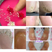 کفسابی پدیکور پا جوانسازی دست|خدمات آرایشگری و زیبایی|سبزوار, فرهنگیان|دیوار