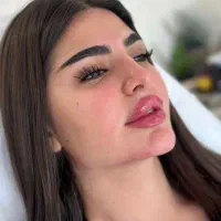 تزریق فیلر یا ژل بوتاکس و پی ارپی