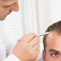 کاشت مو/پیوند مو/کاشت ابرو/کاشت ریش|خدمات آرایشگری و زیبایی|شیراز, وحدت|دیوار