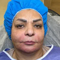 فرمدهی ساعتشنی بدن ساکشن و تزریق چرب|خدمات آرایشگری و زیبایی|رفسنجان, |دیوار