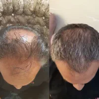 محلول امریکایی اکسونیم رسید شلمزار