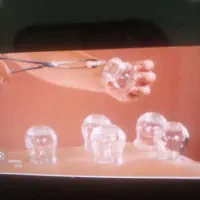 خدمات حجامت دعا نویس طبابت افتادگی ناف بادکش ماساژ