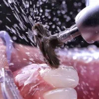 آموزش تجربی دستیار دندانپزشک-دندانپزشکی -دندانسازی