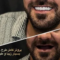 دندانسازی دندانپزشکی