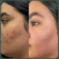 زیبایی طبیعی فقط و فقط با یک کرم