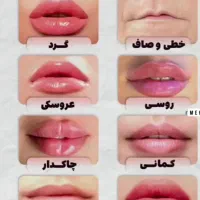 جشنواره روز مادر ژل وبوتاکس ونخ مزو ،چربی