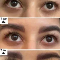درمان ریزش مو و لک پوستی با محصولات اصل تراست