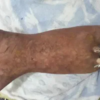 تعدای مشک|ظروف نگهدارنده، پلاستیکی، یکبارمصرف|کشکوئیه, |دیوار