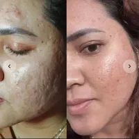 کرمم ترمیم کننده بیوممتیک
