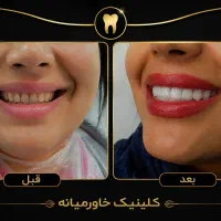 بزرگترین جشنواره سال دندانپزشکی درمجهزترین کلینیک|خدمات زیبایی و سلامت|شیراز, عفیف‌آباد|دیوار