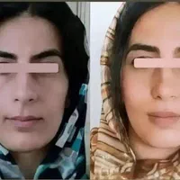 فروش جوانه گندم اصل برند بین استار|آرایشی، بهداشتی، درمانی|بانه, |دیوار