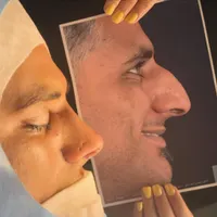 جراحی بینی شیراز /بلفاروپلاستی/ نوبت گیری /وام|خدمات آرایشگری و زیبایی|مرودشت, تامین اجتماعی‎|دیوار