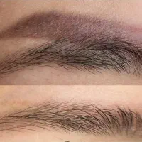 ریموو تتو و میکرو صورت و ابرو