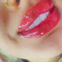 جشنواره/تخفیفی/شیدینگ/تیرگی/لب