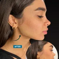 لیفت ابرو پکیج مادلینگ ژل لب بوتاکس فیلر بادی بینی|خدمات آرایشگری و زیبایی|اصفهان, سپاهان‌شهر|دیوار