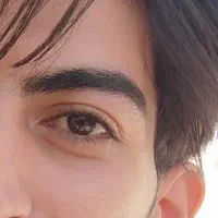 مشاوره رایگان چشم