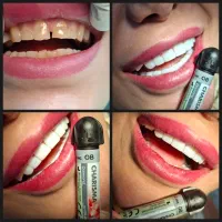 جشنواره دندان پزشکی و کامپوزیت دندان|خدمات آرایشگری و زیبایی|پاکدشت, شهرک امام رضا|دیوار