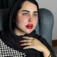 تزریق ژل فیلر و بوتاکس فقط۳۵۰هزار