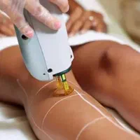 جشنواره مرکز کلینیک لیزر