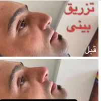 جشنواره پاییزه و افتتاح کلینیک بوتاکس وفیلر|خدمات آرایشگری و زیبایی|ارومیه, |دیوار