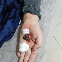 حجامت،زالو‌درمانی، فصدخون،طب سوزنی،مزاج شناسی|خدمات آرایشگری و زیبایی|تهران, بیسیم|دیوار