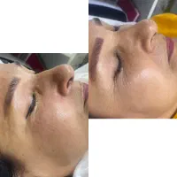 ارائه خدمات پوستی در محله تسلیحات از ۶۰۰ هزارتومان|خدمات زیبایی و سلامت|تهران, تسلیحات|دیوار