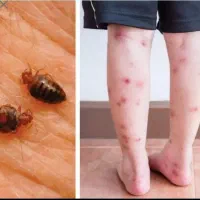 سمپاشی وموریانه زدایی سوسک وساس ۱۰۰٪تضمینی