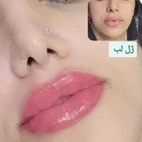 بوتاکس ۳۹۰ ت