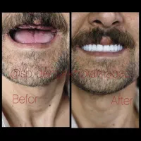 مرکز تخصصی دندانسازی اسپی دنتال|خدمات آرایشگری و زیبایی|خرمآباد, |دیوار