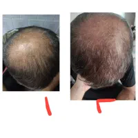 روغن تقویت و رشد مجدد مو|خوردنی و آشامیدنی|تهران, نارمک جنوبی|دیوار