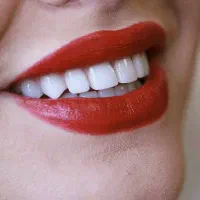 اقساطی دندانپزشکی