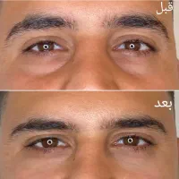 تزریق بوتاکس توسط پزشک ۷۸۰ت|خدمات آرایشگری و زیبایی|شیراز, کوی وحدت|دیوار