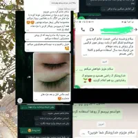 روغن ترکیبی مو درمان ریزش مو