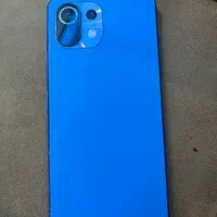 شیائومی می ۱۱ لایت mi11 lite