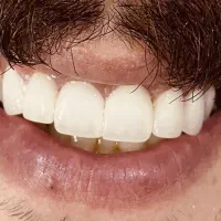 خدمات دندانپزشکی|خدمات آرایشگری و زیبایی|یاسوج, |دیوار