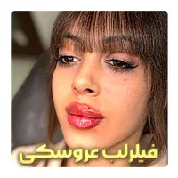 فیلر لب ۱ ملیون، بوتاکس ۶۵۰ هزارتومن|خدمات آرایشگری و زیبایی|تهران, مهرآباد|دیوار